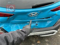 هيونداي كونا